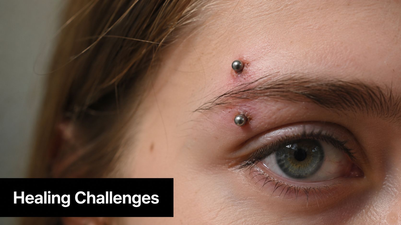 A close-up of a person with an irritated eyebrow piercing showing signs of redness and skin inflammation.
