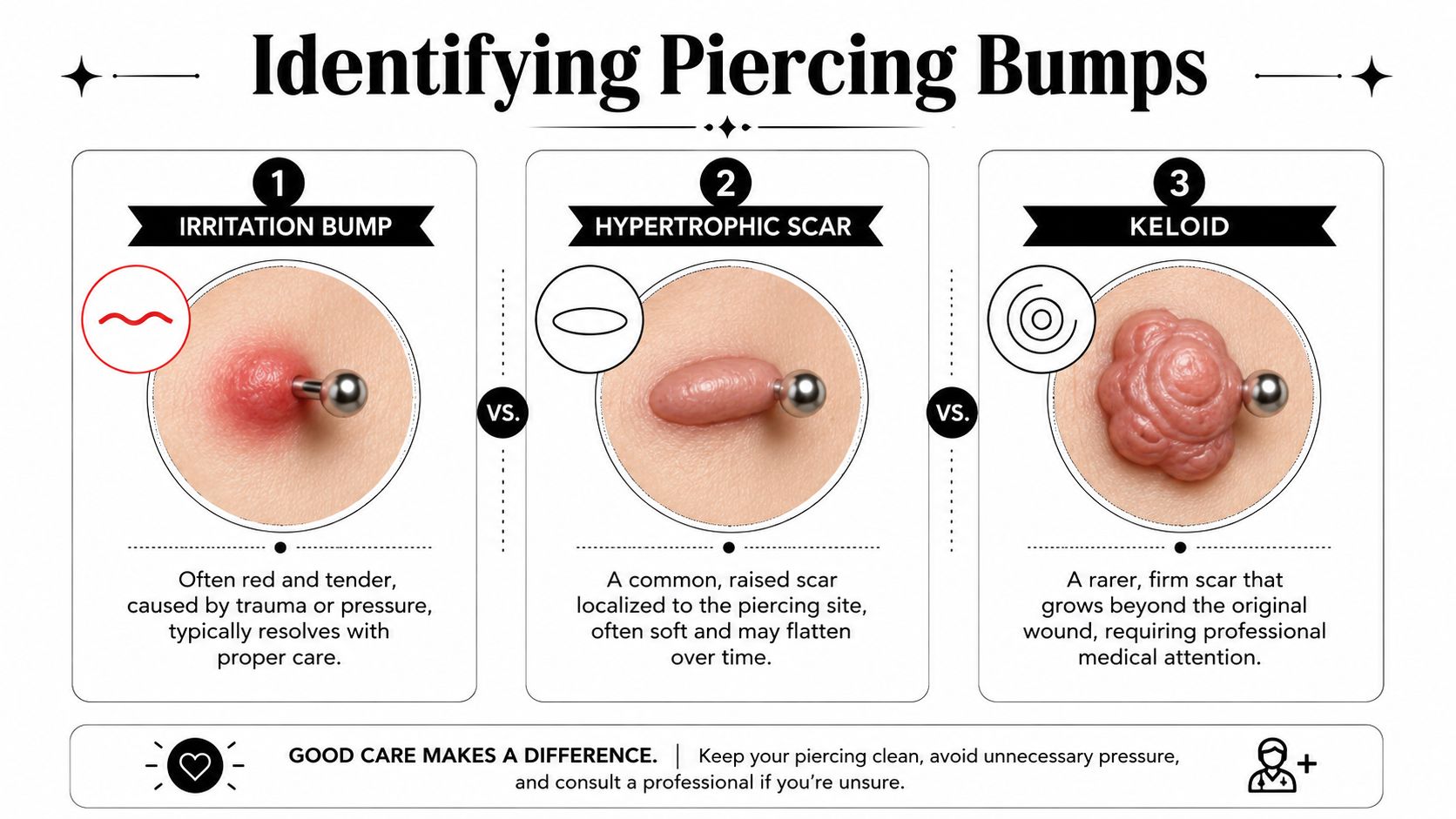 A diagram comparing three types of piercing bumps: irritation bump, hypertrophic scar, and keloid for identification.