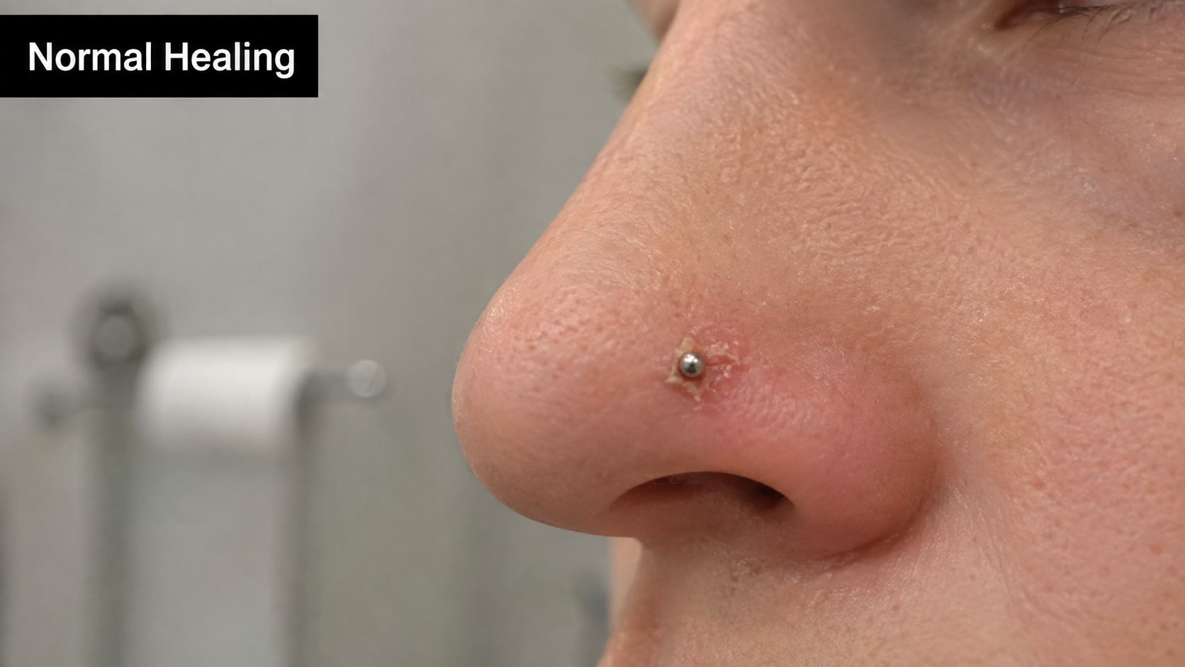 A close-up view of a nose piercing showing signs of normal healing with slight crusting.
