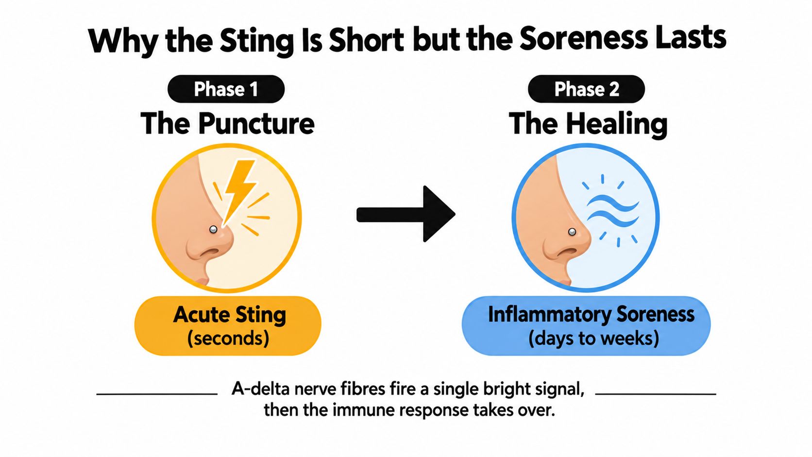 A diagram explaining why a nose piercing causes a short sting followed by days of healing soreness.